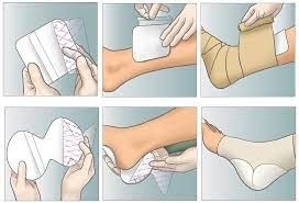 Skumförband silikon Mepilex Heel, 13x20cm Häl - Mepilex - 2