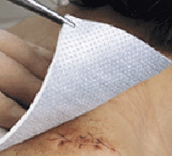 Kompress aluminium Metalline, 10x12cm steril - Metalline