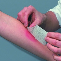 Kompress klorhexidin Bactigras, 5x5cm - Bactigras