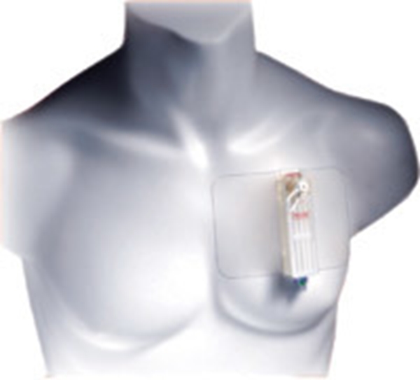 Thoraxdränage Tru-Close Thoracic Vent, 13Fr längd 13cm