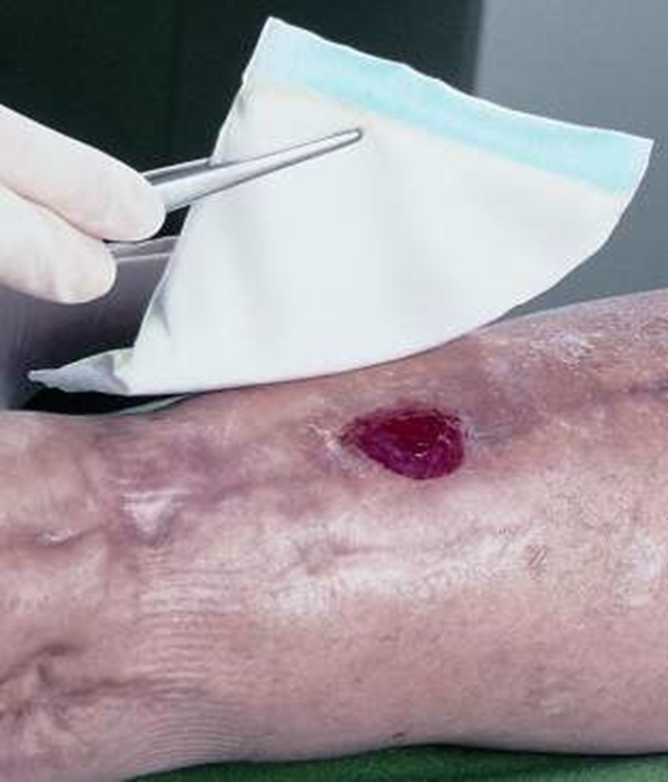 Absorberande förband Vliwazell, 10x10cm steril - Vliwazell