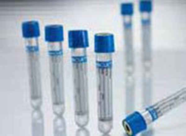 Vakuumrör VACUETTE transparent etikett, 5/3,5ml CTAD ljusblå