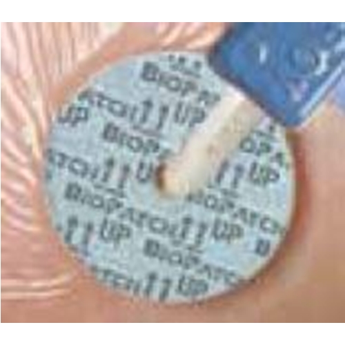 Kompress klorhexidin Biopatch disk - Ø1,9cm hål 1,5mm < 6Fr - 40 st