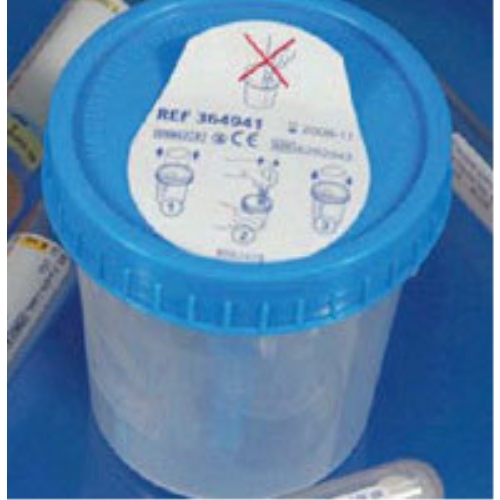 Urinbägare med lock BD Vacutainer - 120ml steril insida - 200 st